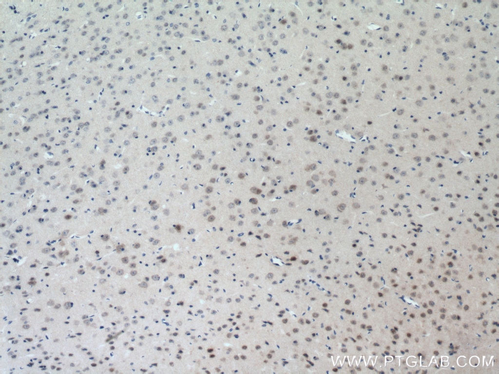 Immunohistochemistry (IHC) staining of mouse brain tissue using TESC Polyclonal antibody (11125-1-AP)