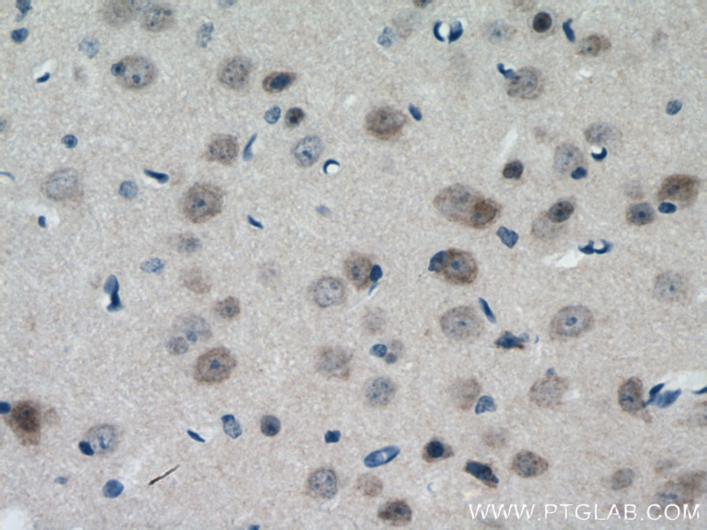 Immunohistochemistry (IHC) staining of mouse brain tissue using TESC Polyclonal antibody (11125-1-AP)