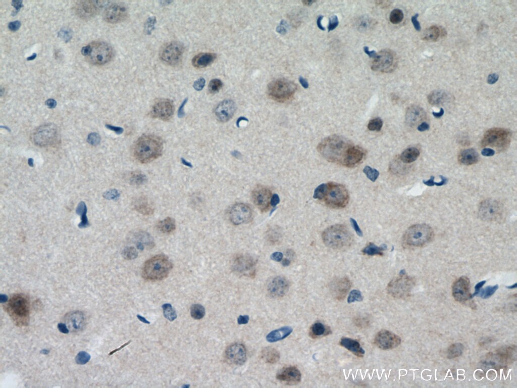 Immunohistochemistry (IHC) staining of mouse brain tissue using TESC Polyclonal antibody (11125-1-AP)