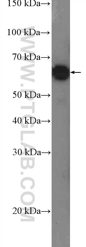 Western Blot (WB) analysis of NCCIT cells using TESK2 Polyclonal antibody (17414-1-AP)