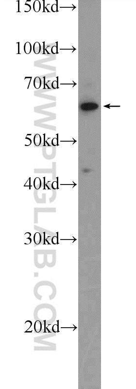 Western Blot (WB) analysis of A431 cells using TESPA1 Polyclonal antibody (25975-1-AP)