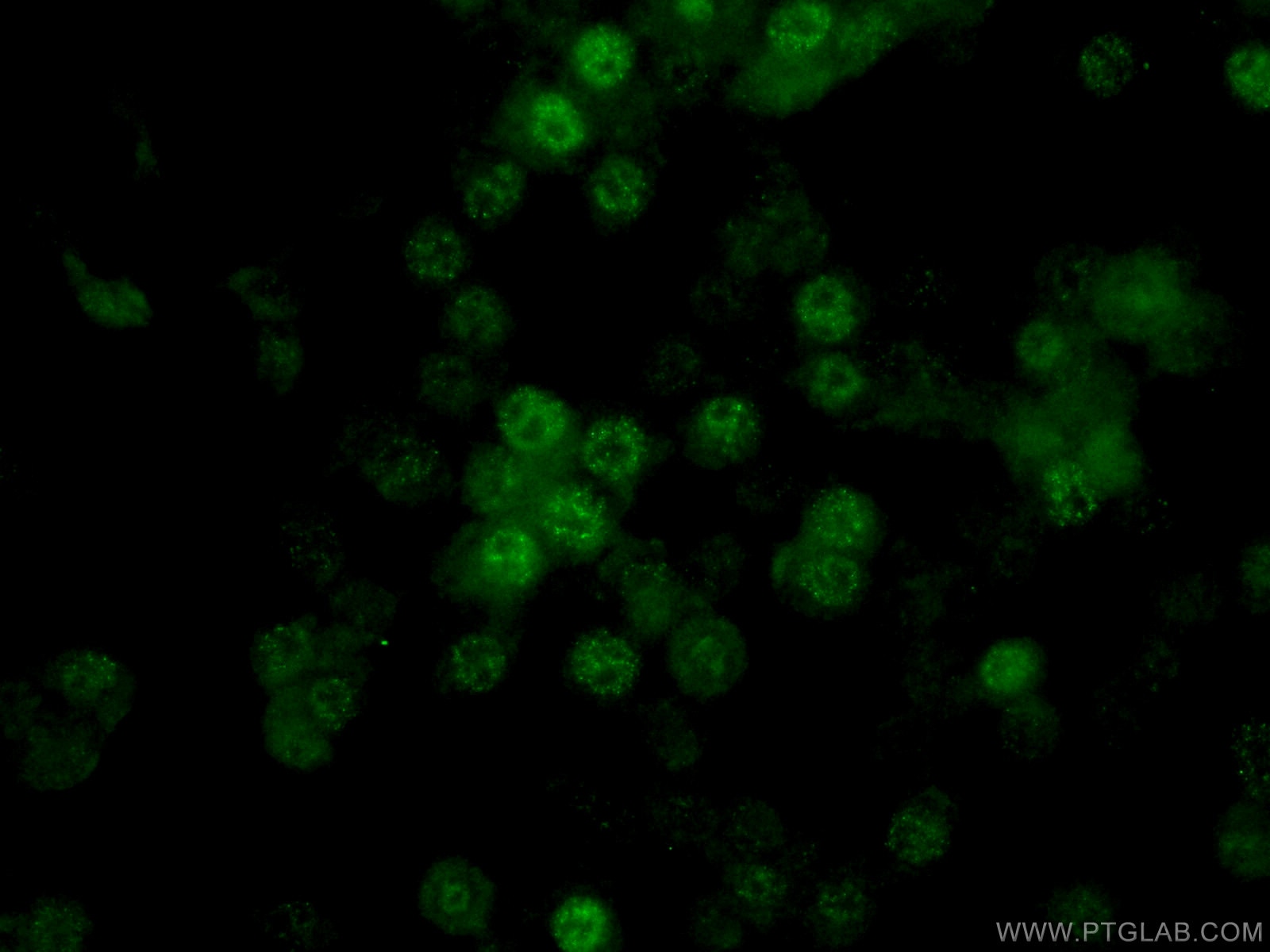 Immunofluorescence (IF) / fluorescent staining of Neuro-2a cells using TET2 Polyclonal antibody (21207-1-AP)