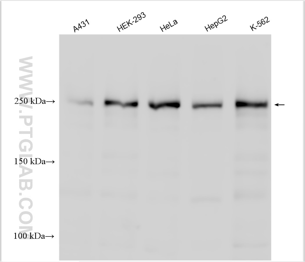 Western Blot (WB) analysis of various lysates using TET2 Polyclonal antibody (21207-1-AP)