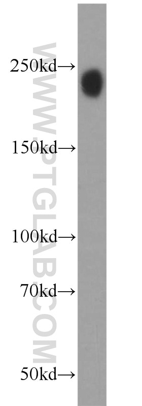 Western Blot (WB) analysis of HL-60 cells using TET2 Polyclonal antibody (21207-1-AP)