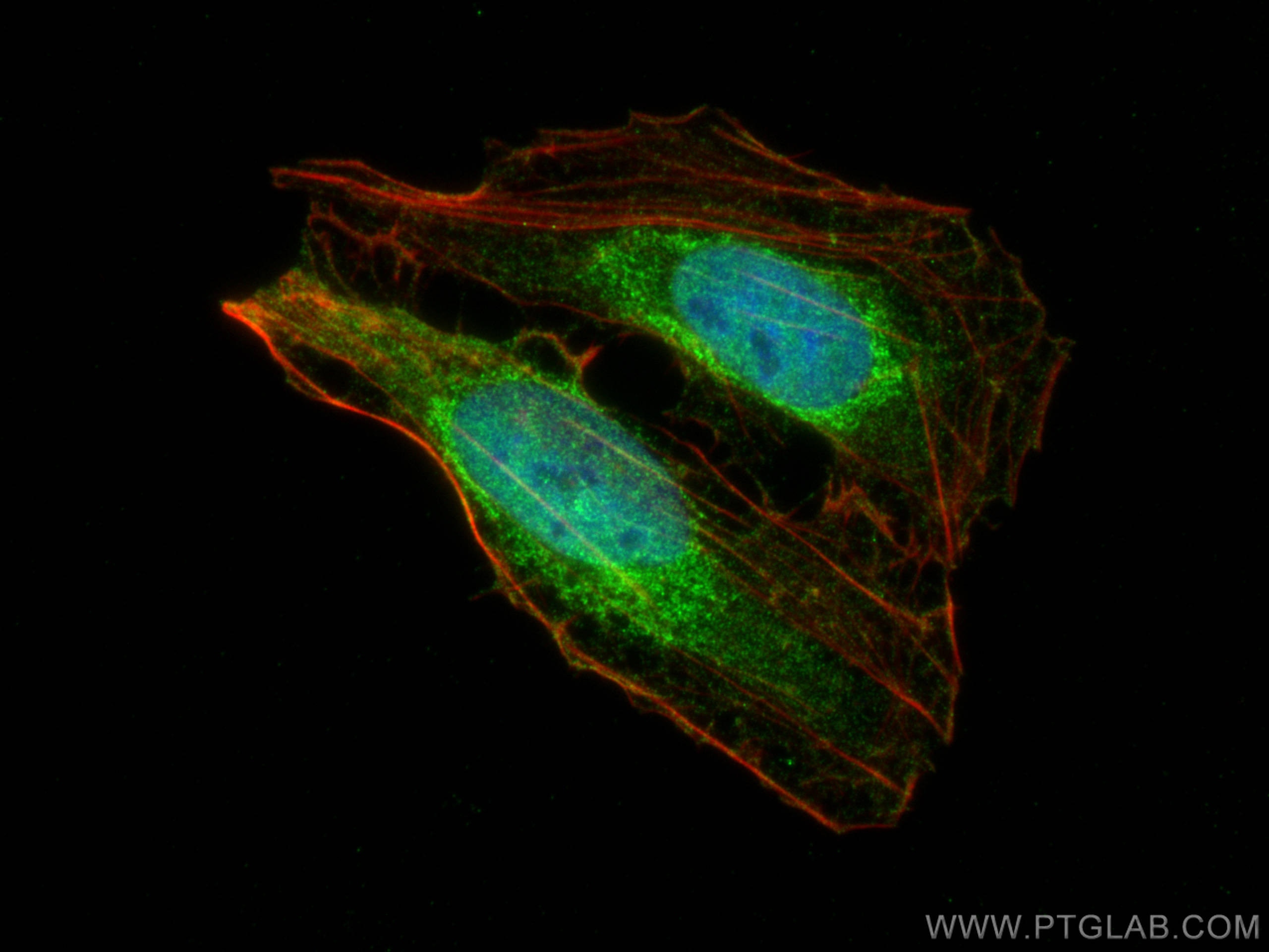 IF Staining of U2OS using 22612-1-AP