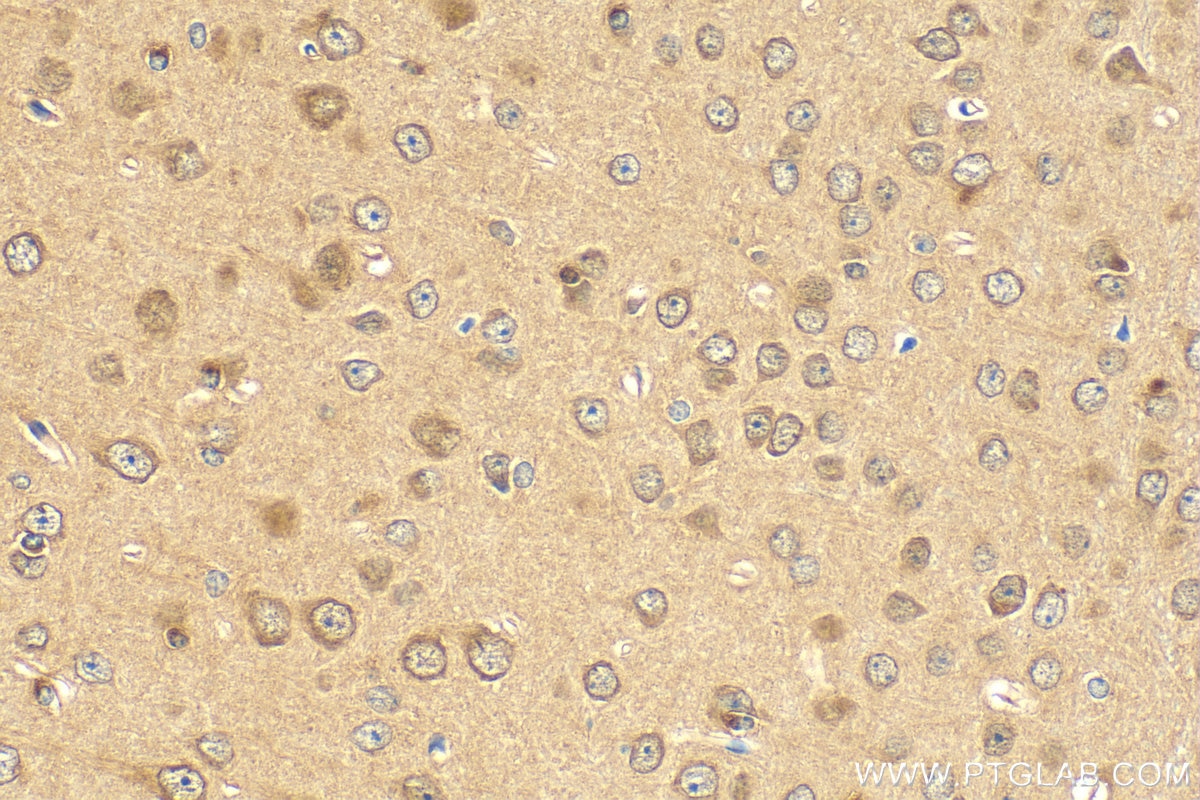 IHC staining of mouse brain using 22612-1-AP