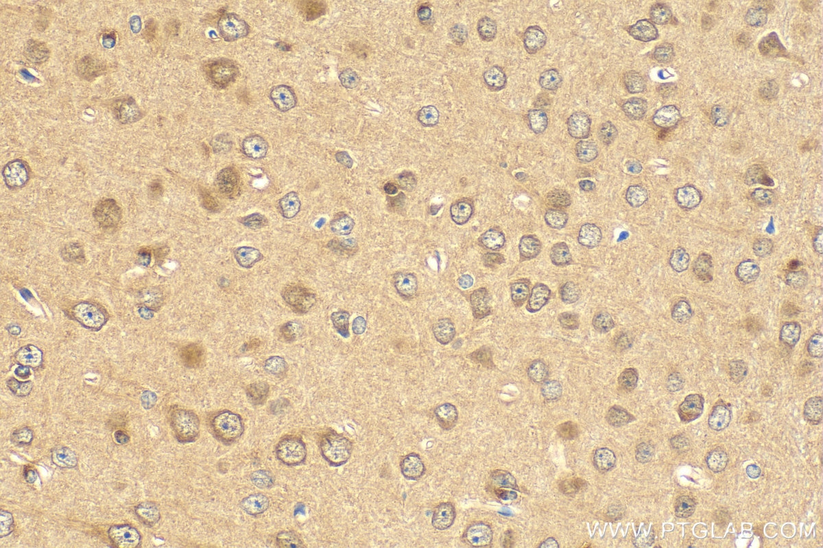 Immunohistochemistry (IHC) staining of mouse brain tissue using TET3 Polyclonal antibody (22612-1-AP)