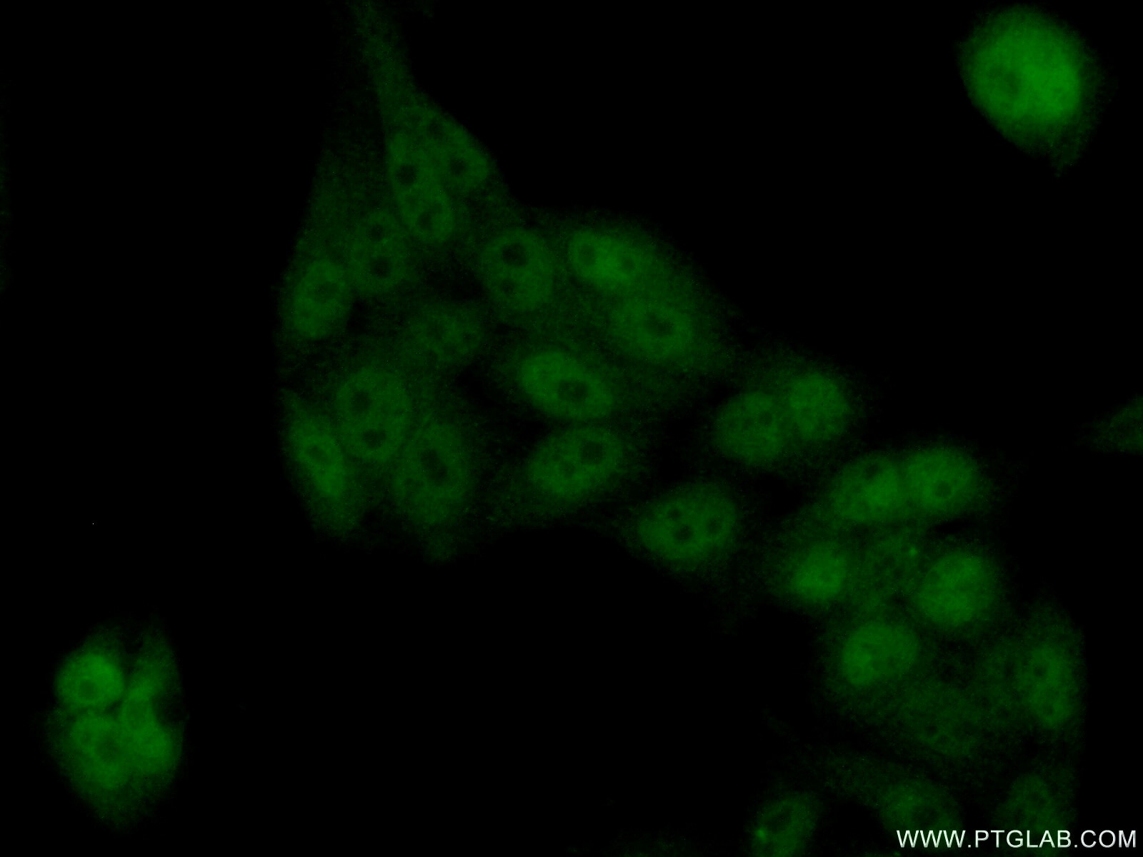 Immunofluorescence (IF) / fluorescent staining of HeLa cells using TEX10 Polyclonal antibody (17372-1-AP)