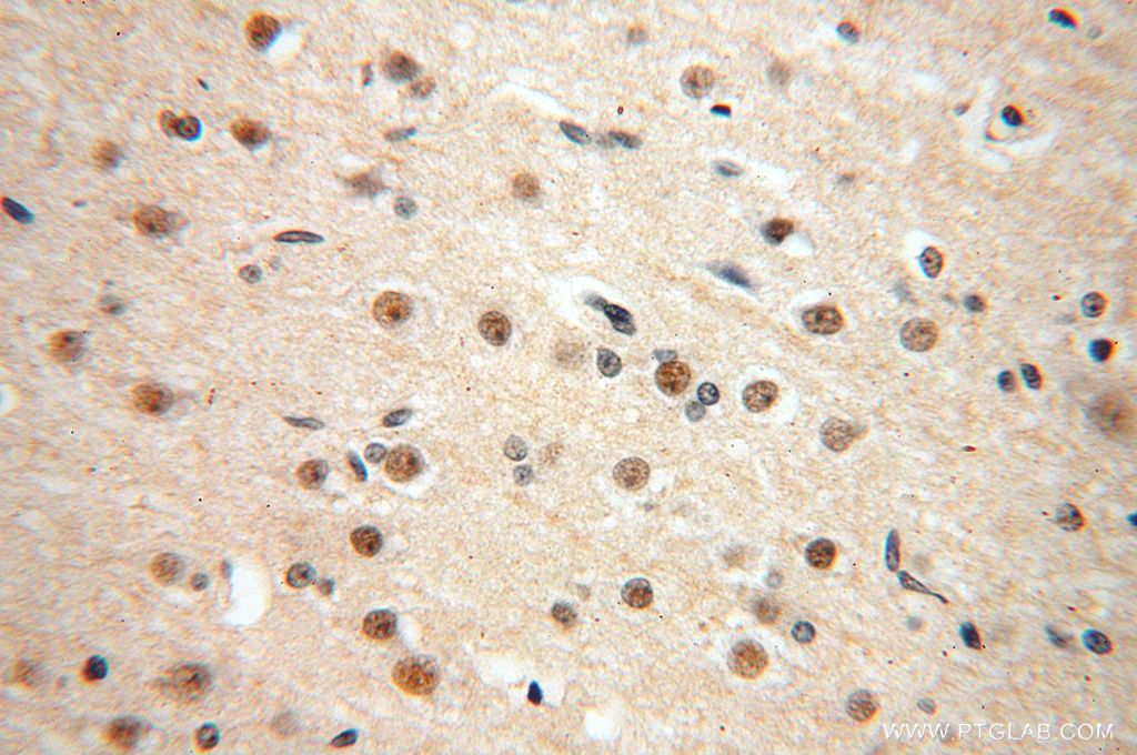 Immunohistochemistry (IHC) staining of human brain tissue using TEX10 Polyclonal antibody (17372-1-AP)