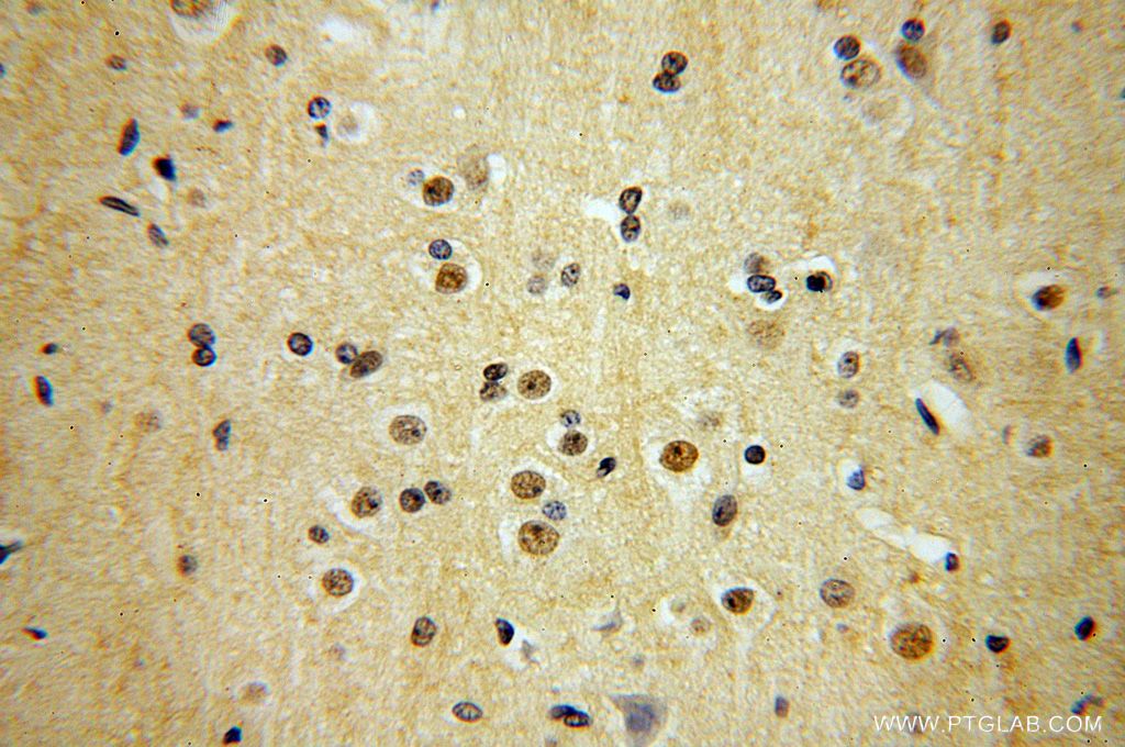 Immunohistochemistry (IHC) staining of human brain tissue using TEX10 Polyclonal antibody (17372-1-AP)