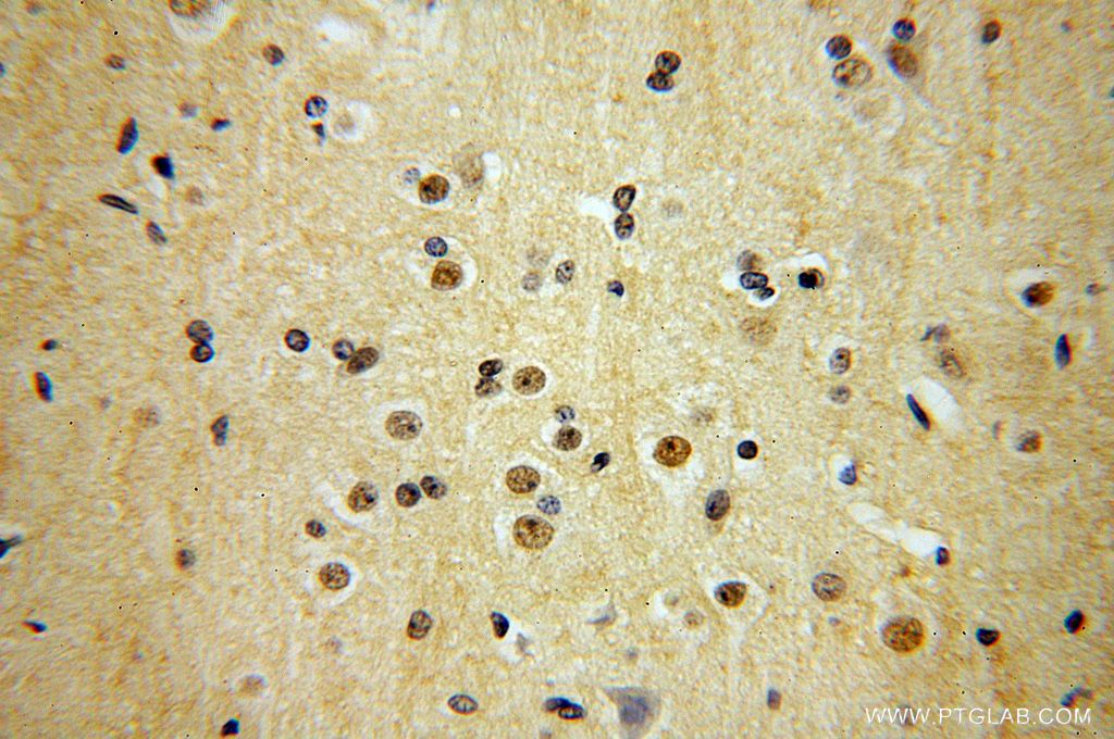 IHC staining of human brain using 17372-1-AP