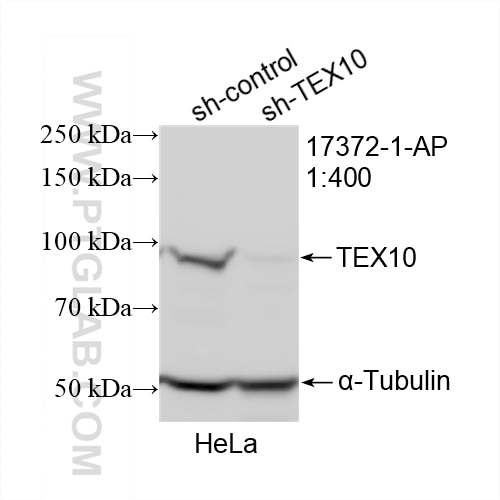 Western Blot (WB) analysis of HeLa cells using TEX10 Polyclonal antibody (17372-1-AP)