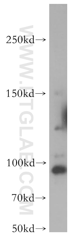 Western Blot (WB) analysis of HeLa cells using TEX10 Polyclonal antibody (17372-1-AP)