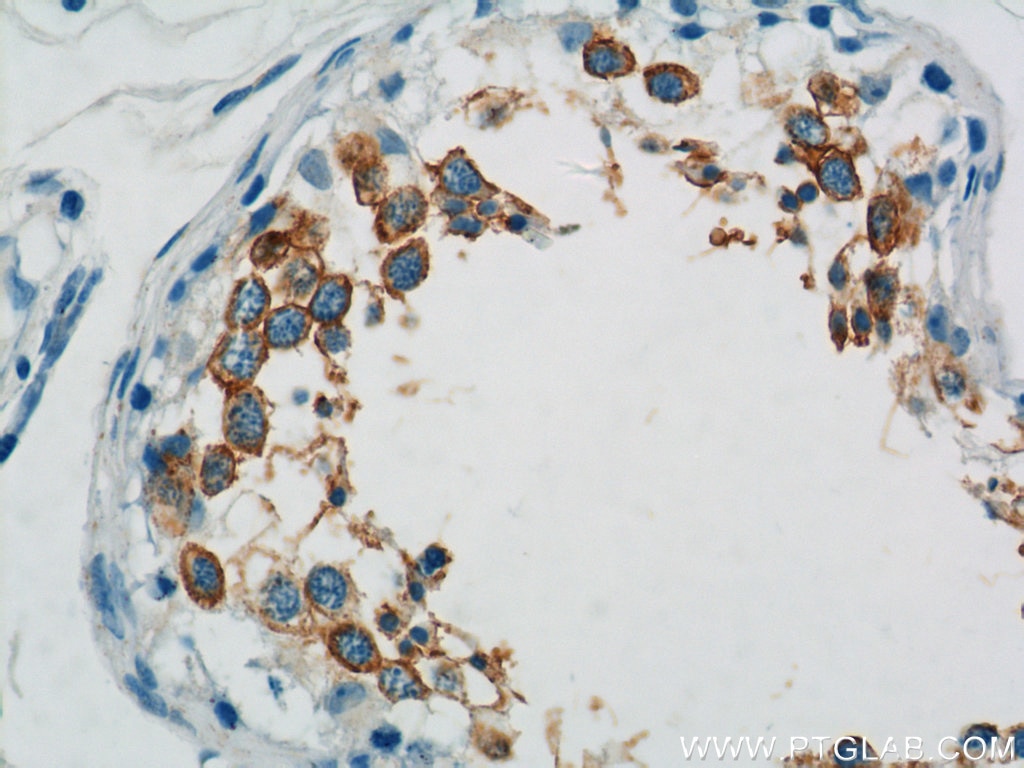 Immunohistochemistry (IHC) staining of human testis tissue using TEX101 Polyclonal antibody (15447-1-AP)