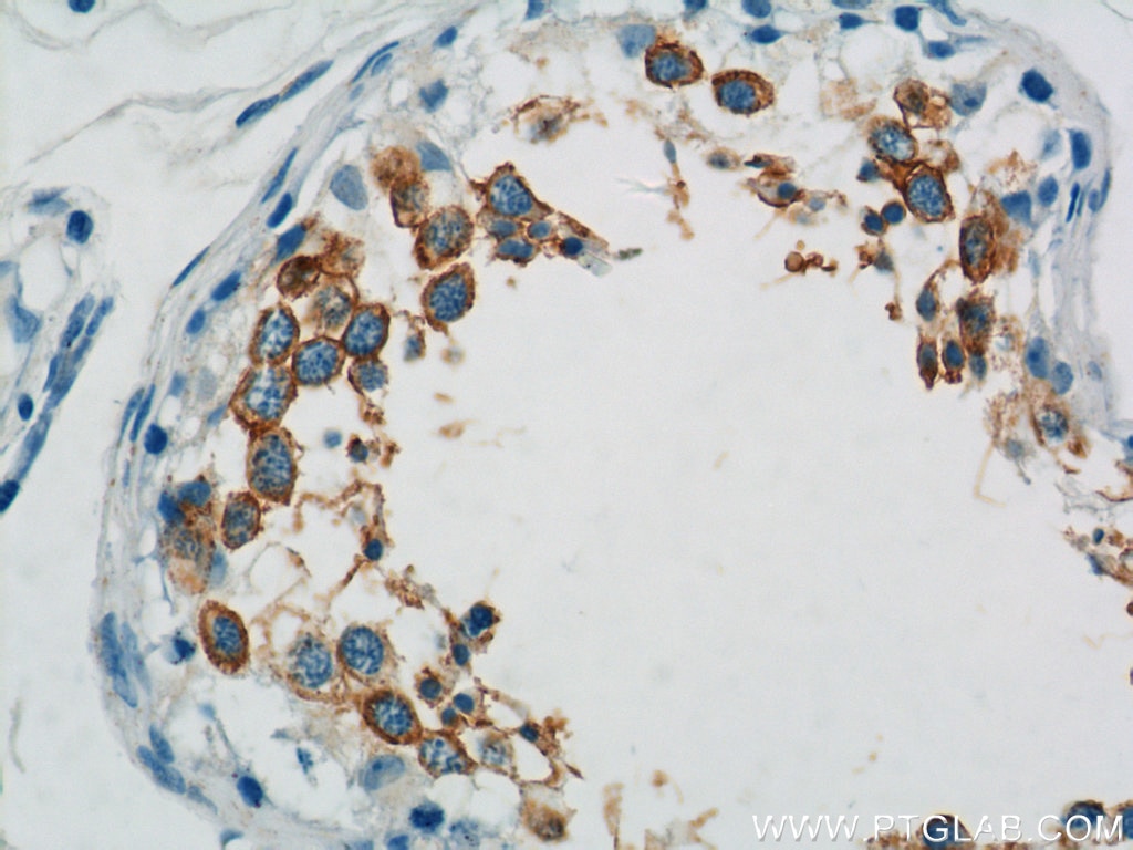 IHC staining of human testis using 15447-1-AP