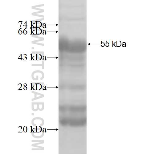 TEX101 fusion protein Ag7611 SDS-PAGE