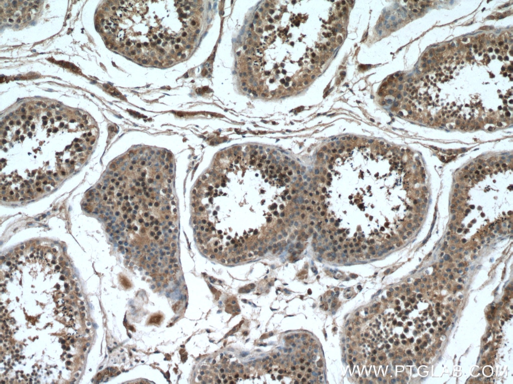 Immunohistochemistry (IHC) staining of human testis tissue using TEX12 Polyclonal antibody (17068-1-AP)