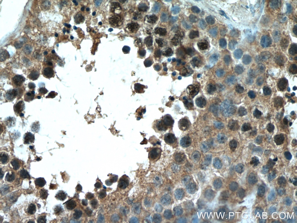 Immunohistochemistry (IHC) staining of human testis tissue using TEX12 Polyclonal antibody (17068-1-AP)