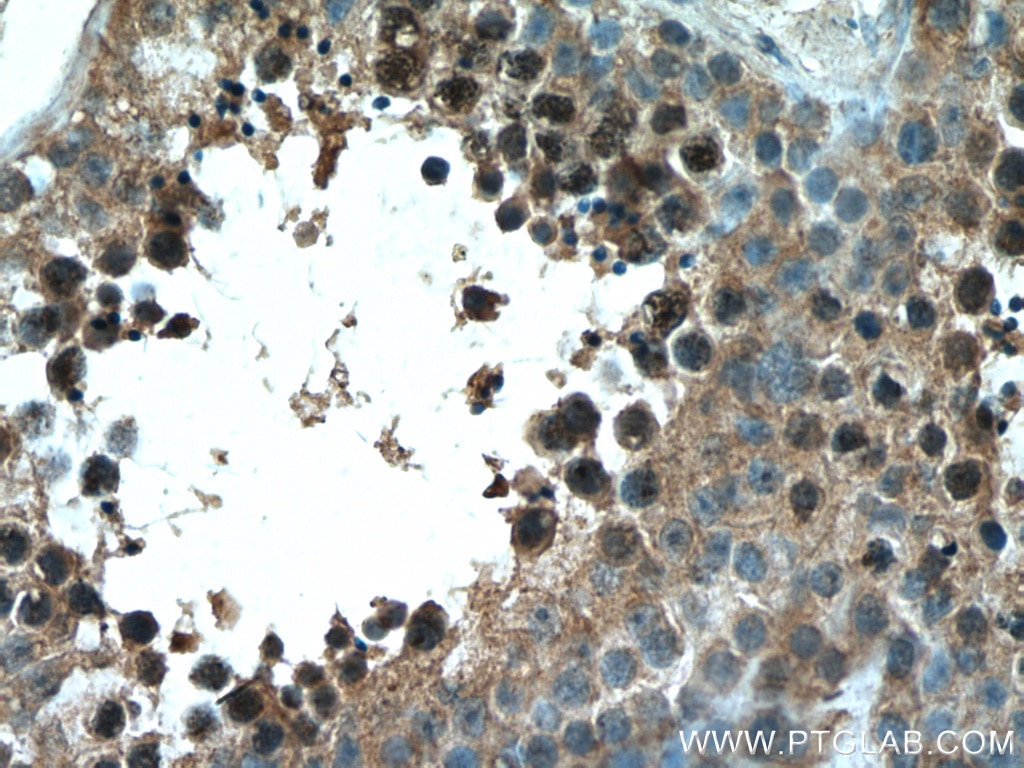 IHC staining of human testis using 17068-1-AP