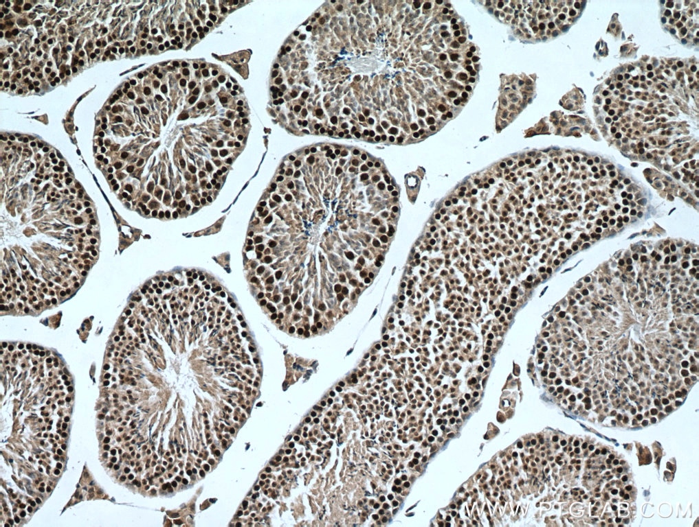 Immunohistochemistry (IHC) staining of mouse testis tissue using TEX12 Polyclonal antibody (17068-1-AP)