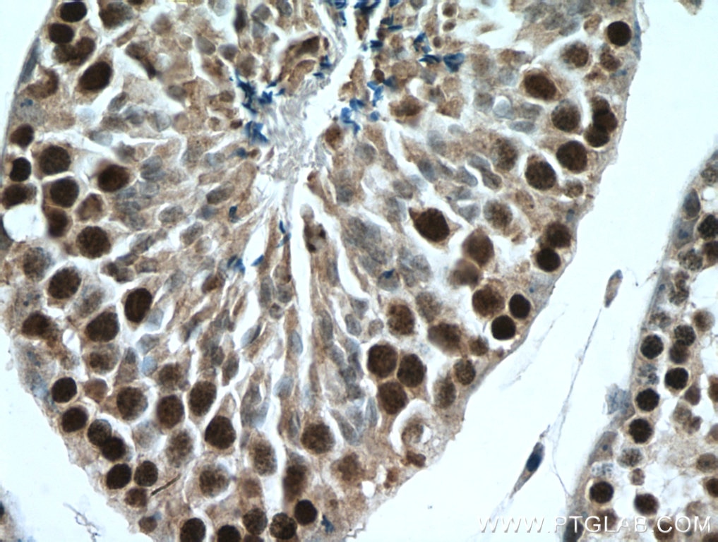 Immunohistochemistry (IHC) staining of mouse testis tissue using TEX12 Polyclonal antibody (17068-1-AP)