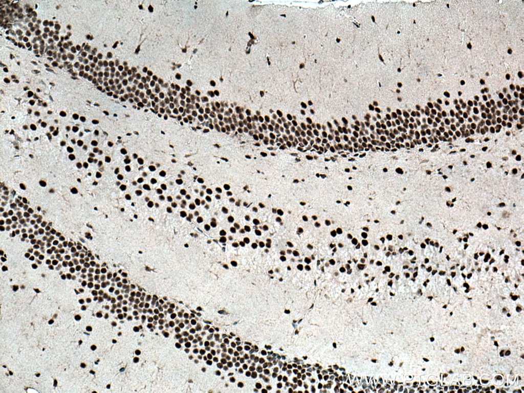 Immunohistochemistry (IHC) staining of mouse brain tissue using TEX12 Polyclonal antibody (17068-1-AP)