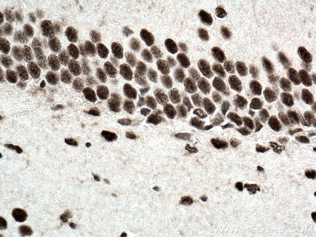 Immunohistochemistry (IHC) staining of mouse brain tissue using TEX12 Polyclonal antibody (17068-1-AP)