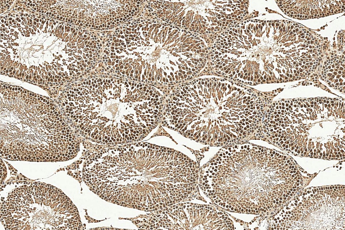 IHC staining of rat testis using 17068-1-AP Immunohistochemistry (IHC) staining of rat testis tissue using TEX12 Polyclonal antibody (17068-1-AP)