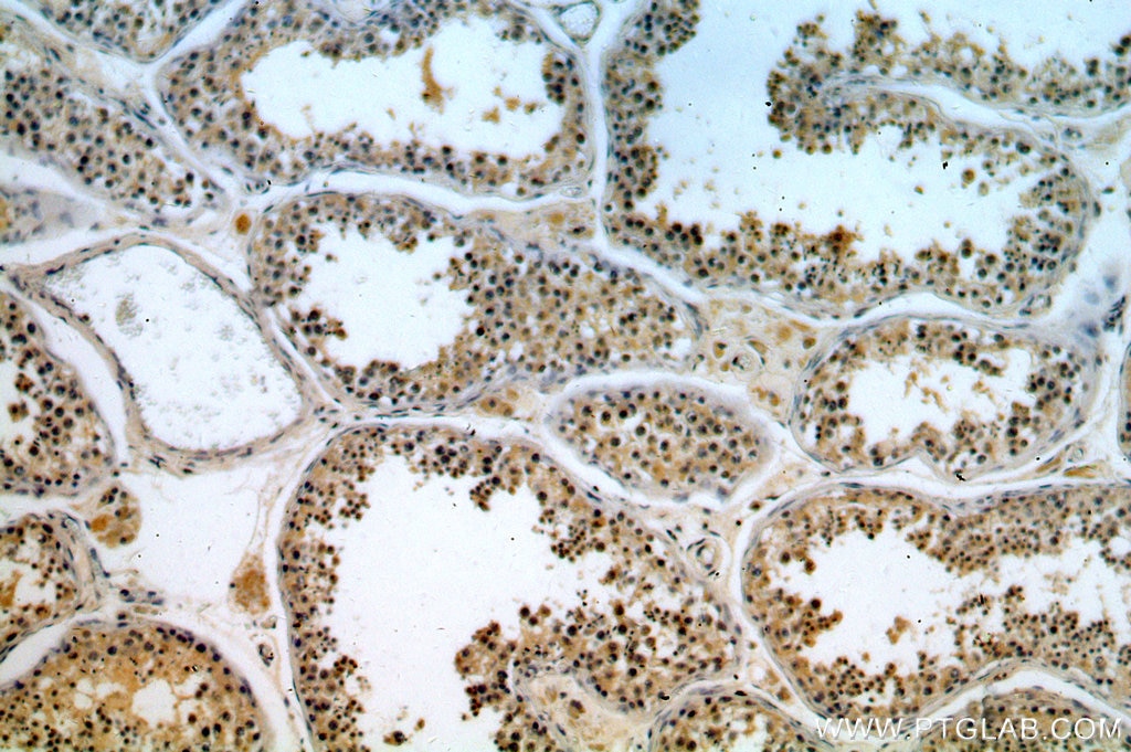 Immunohistochemistry (IHC) staining of human testis tissue using TEX13A Polyclonal antibody (18888-1-AP)