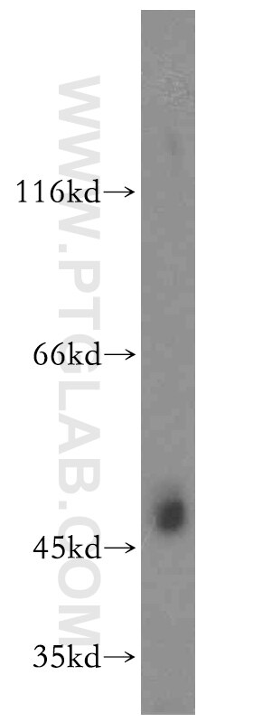 Western Blot (WB) analysis of PC-3 cells using TEX13A Polyclonal antibody (18888-1-AP)