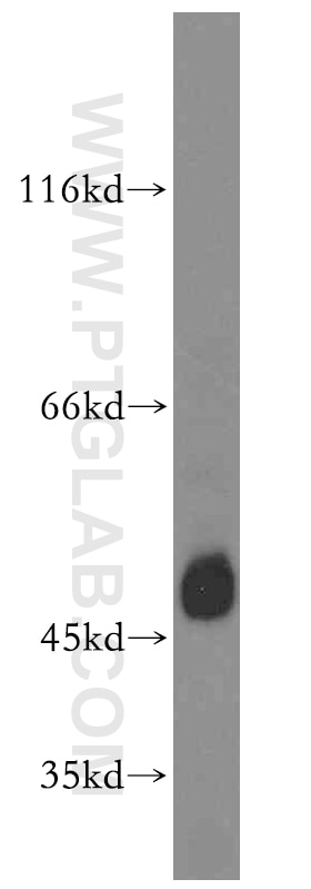Western Blot (WB) analysis of HL-60 cells using TEX13A Polyclonal antibody (18888-1-AP)