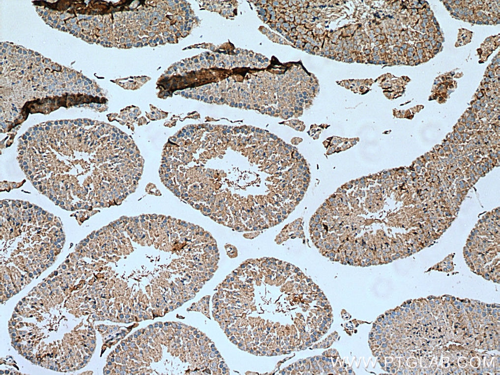 Immunohistochemistry (IHC) staining of mouse testis tissue using TEX14 Polyclonal antibody (18351-1-AP)