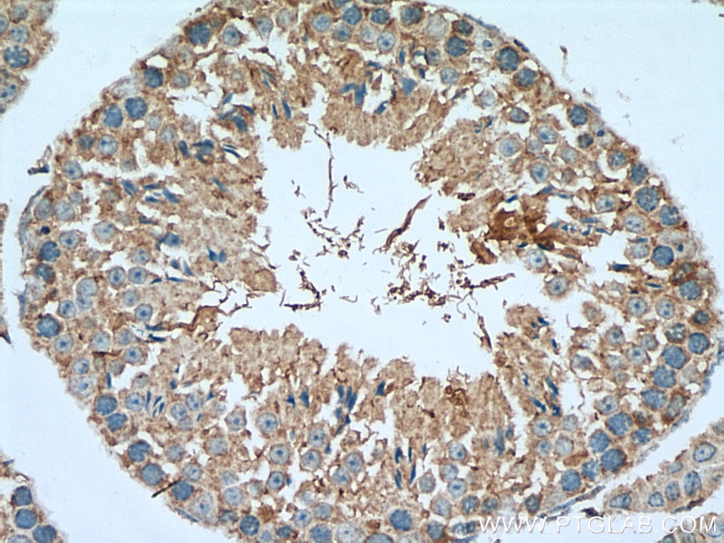 Immunohistochemistry (IHC) staining of mouse testis tissue using TEX14 Polyclonal antibody (18351-1-AP)
