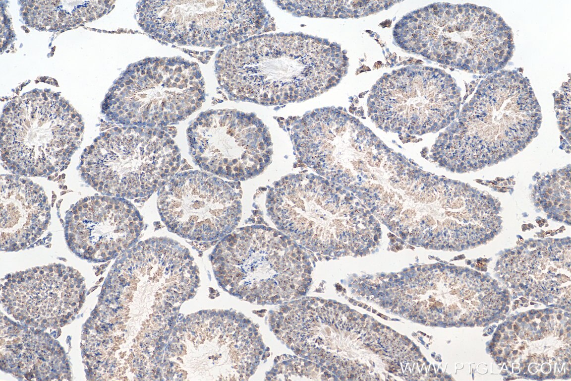 Immunohistochemistry (IHC) staining of mouse testis tissue using TEX14 Polyclonal antibody (18351-1-AP)