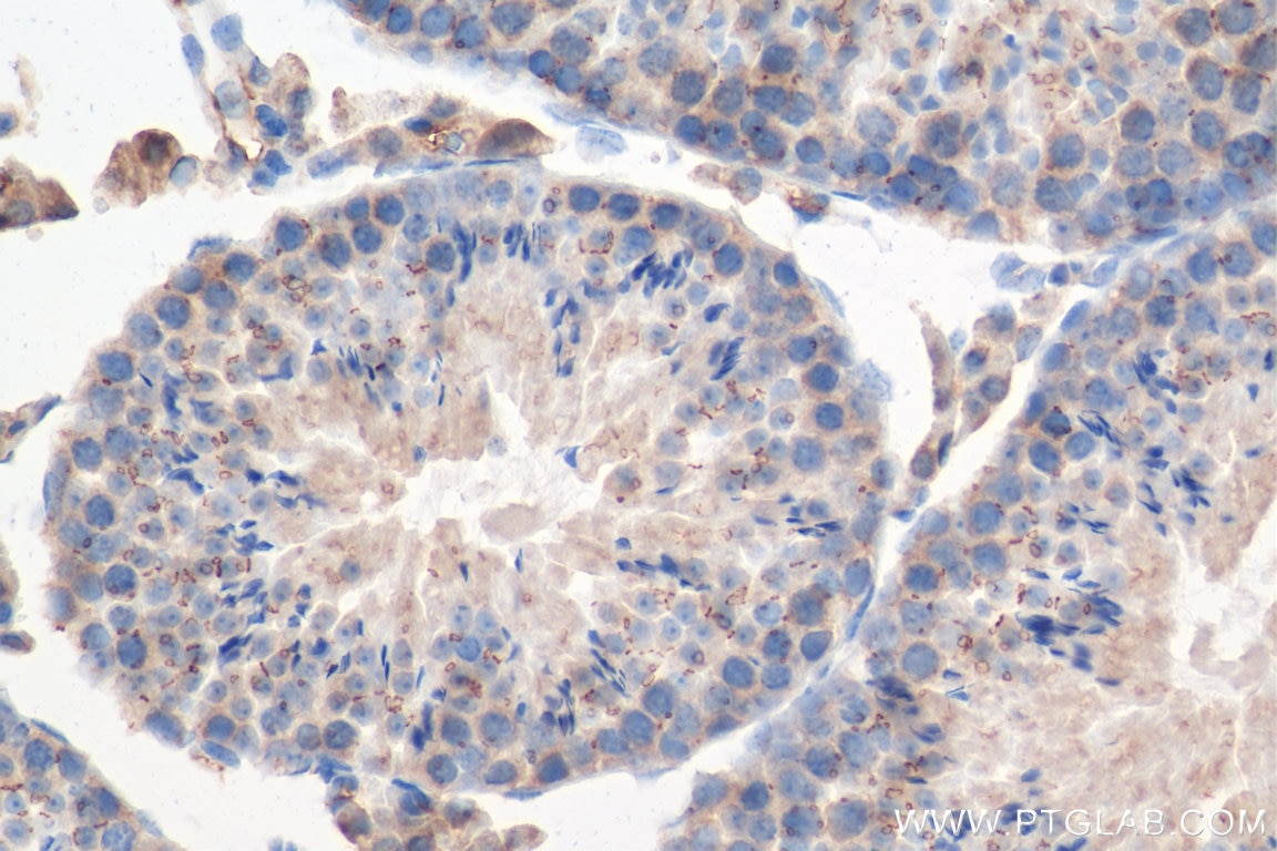 Immunohistochemistry (IHC) staining of mouse testis tissue using TEX14 Polyclonal antibody (18351-1-AP)