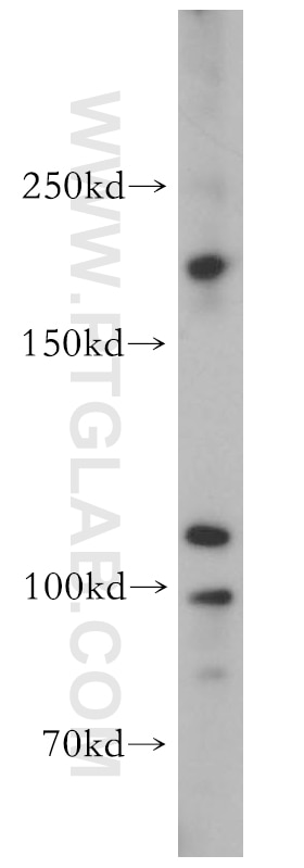 Western Blot (WB) analysis of mouse testis tissue using TEX14 Polyclonal antibody (18351-1-AP)