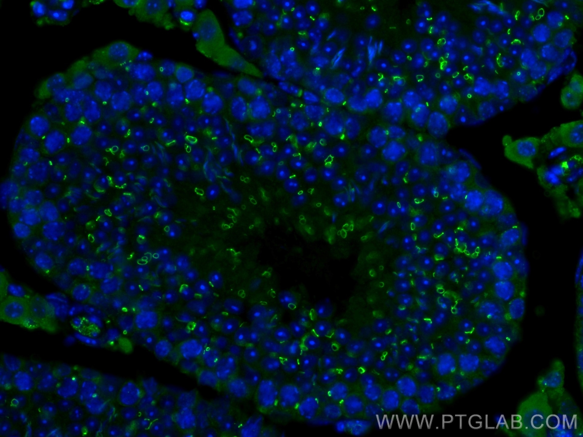 Immunofluorescence (IF) / fluorescent staining of mouse testis tissue using TEX14 Monoclonal antibody (67982-1-Ig)