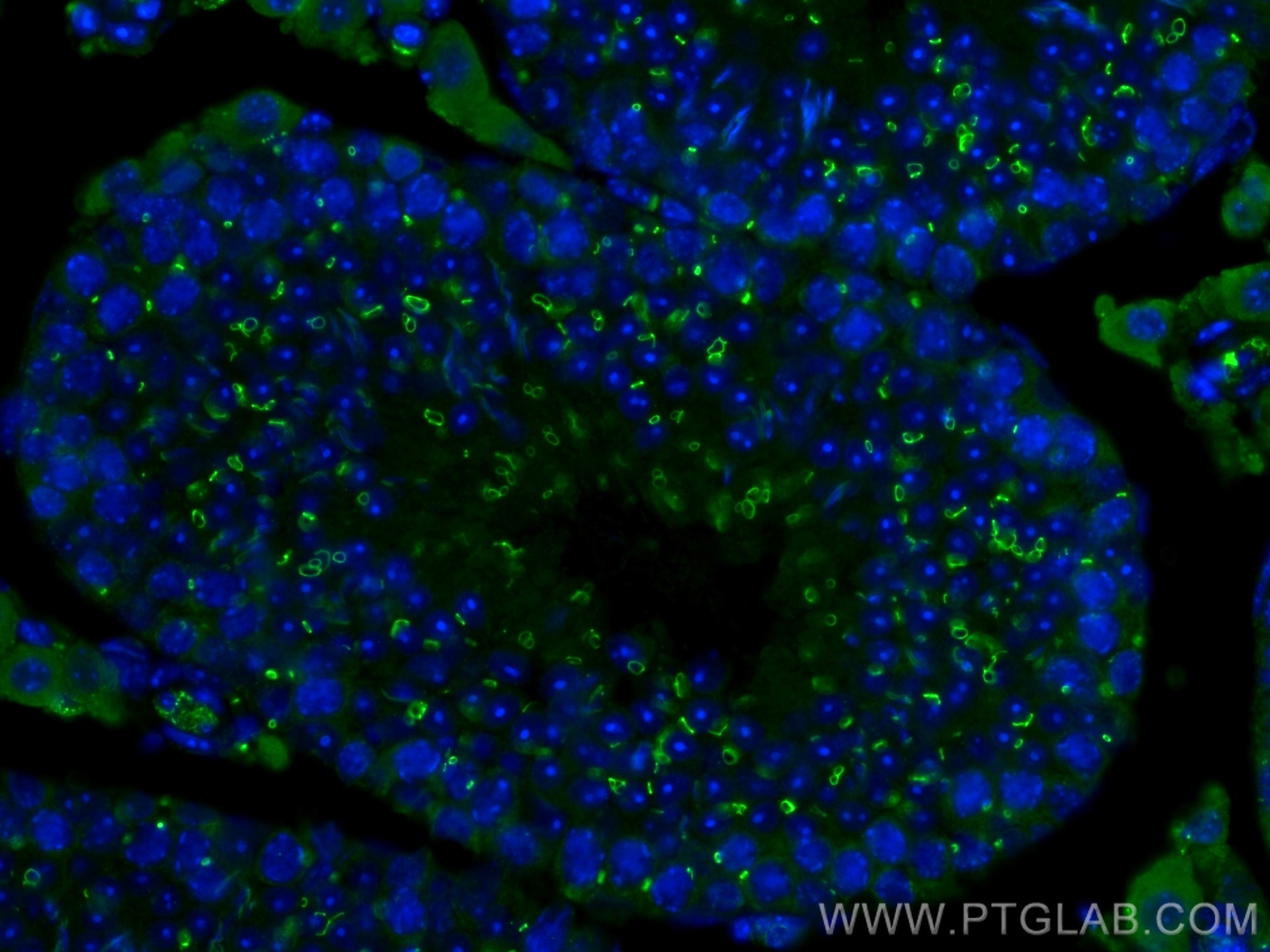 Immunofluorescence (IF) / fluorescent staining of mouse testis tissue using TEX14 Monoclonal antibody (67982-1-Ig)