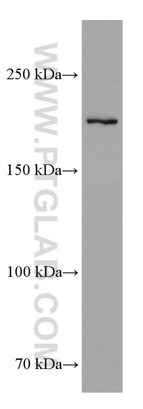 Western Blot (WB) analysis of PC-3 cells using TEX14 Monoclonal antibody (67982-1-Ig)