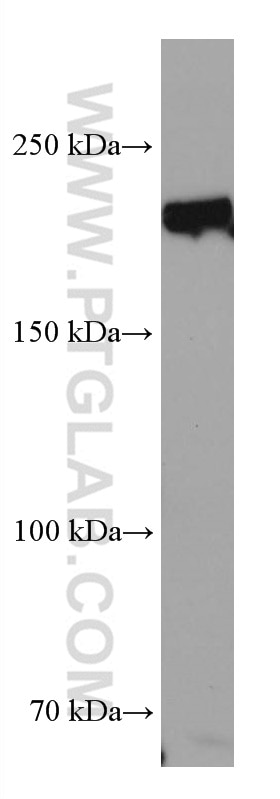 Western Blot (WB) analysis of rat testis tissue using TEX14 Monoclonal antibody (67982-1-Ig)