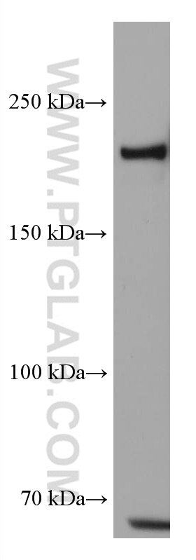 Western Blot (WB) analysis of mouse testis tissue using TEX14 Monoclonal antibody (67982-1-Ig)