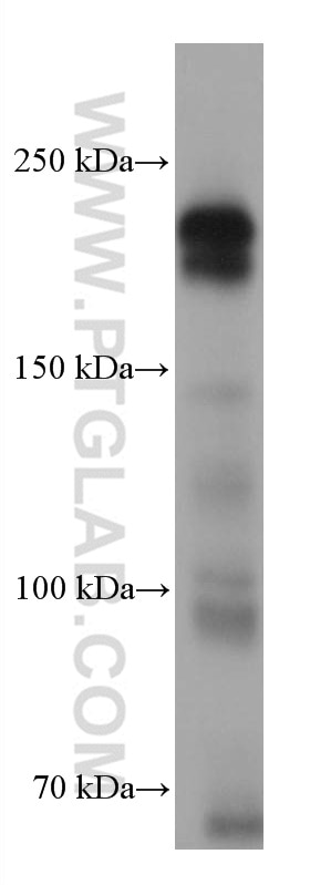Western Blot (WB) analysis of rabbit testis tissue using TEX14 Monoclonal antibody (67982-1-Ig)
