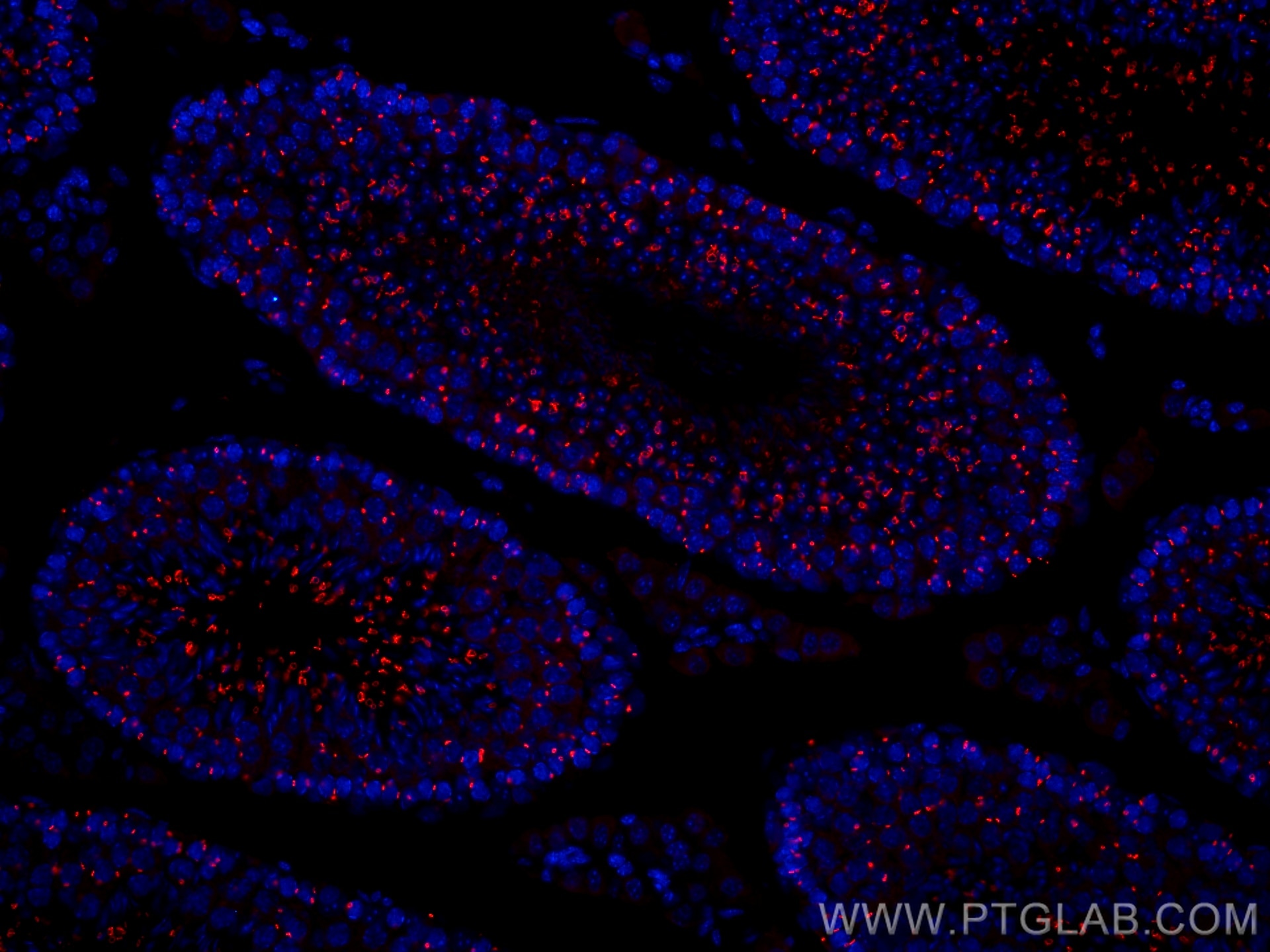 Immunofluorescence (IF) / fluorescent staining of mouse testis tissue using CoraLite®594-conjugated TEX14 Monoclonal antibody (CL594-67982)