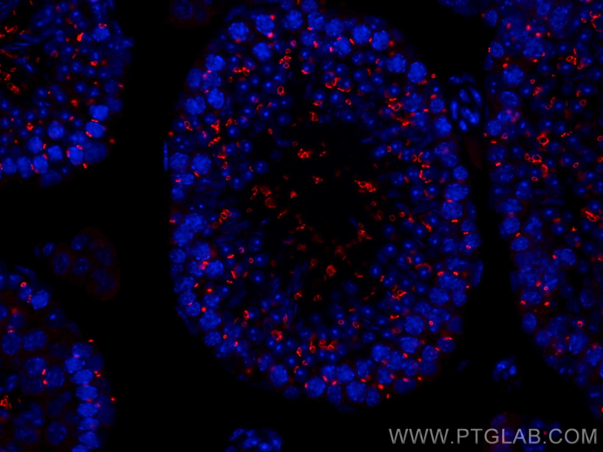 Immunofluorescence (IF) / fluorescent staining of mouse testis tissue using CoraLite®594-conjugated TEX14 Monoclonal antibody (CL594-67982)
