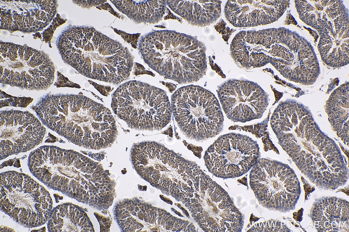 Immunohistochemistry (IHC) staining of mouse testis tissue using TEX15 Polyclonal antibody (24585-1-AP)