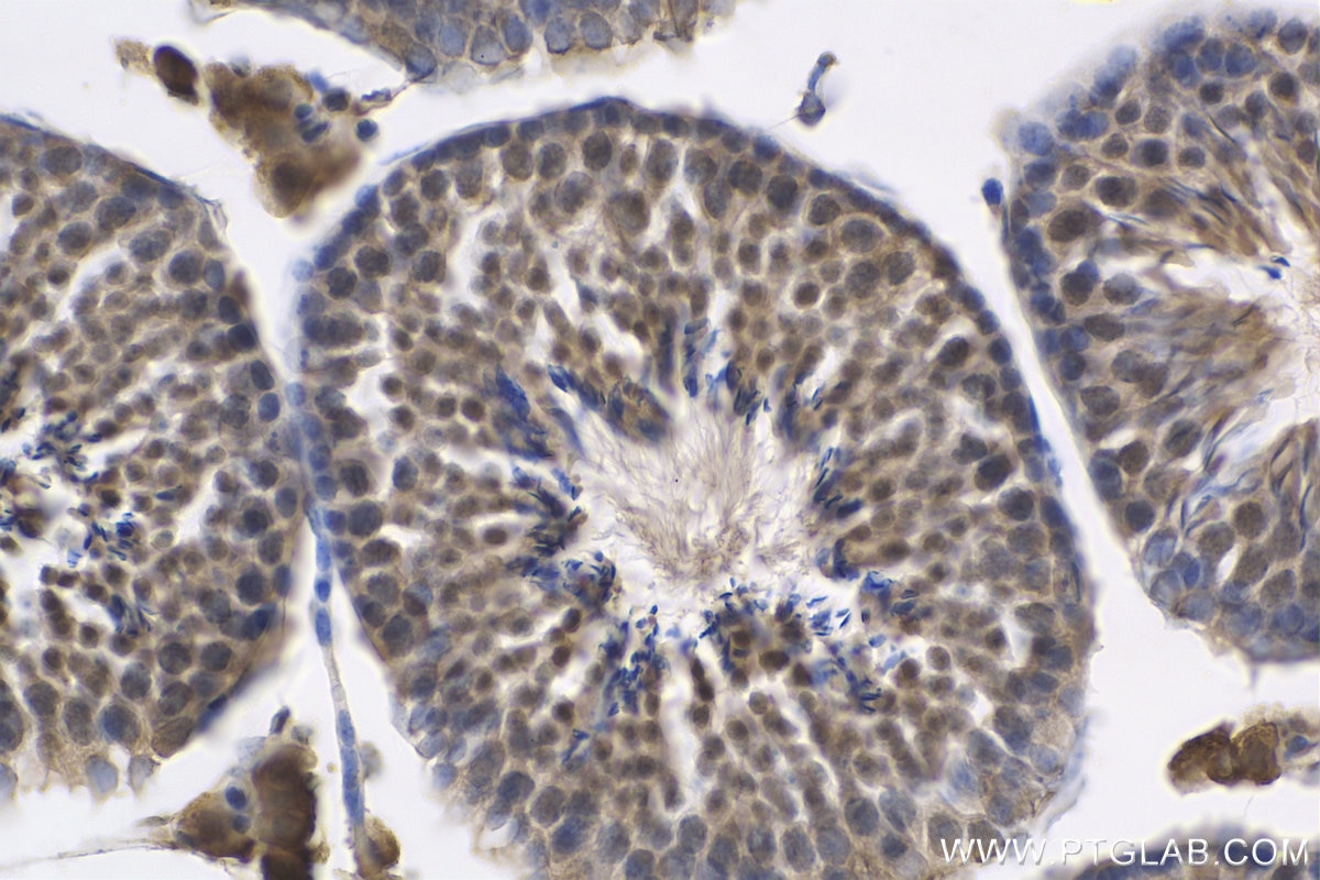 Immunohistochemistry (IHC) staining of mouse testis tissue using TEX15 Polyclonal antibody (24585-1-AP)