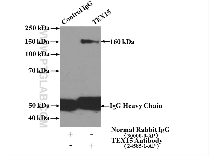 Immunoprecipitation (IP) experiment of PC-3 cells using TEX15 Polyclonal antibody (24585-1-AP)