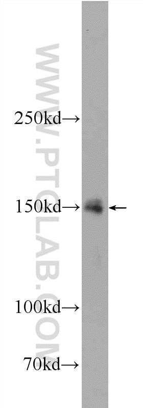 Western Blot (WB) analysis of rat testis tissue using TEX15 Polyclonal antibody (24585-1-AP)