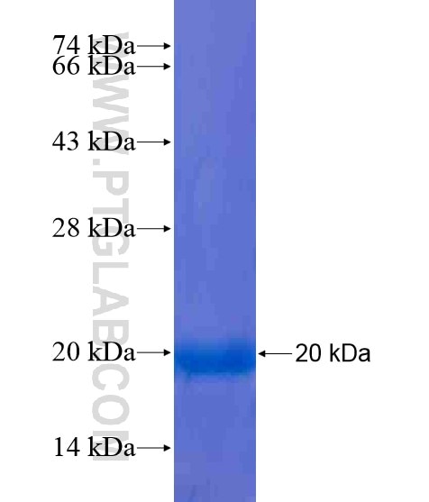 TEX15 fusion protein Ag20490 SDS-PAGE