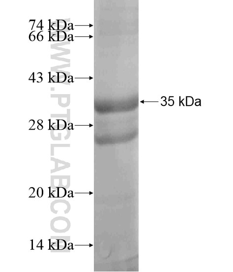 TEX261 fusion protein Ag19093 SDS-PAGE
